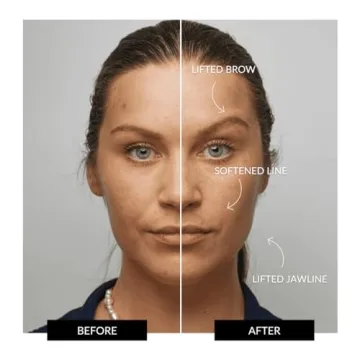 ZIIP Halo Facial Device for Youthful Glowing Skin at Home