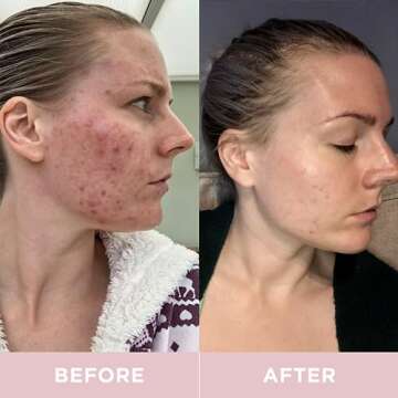 Revive Collagen Premium 8,500mg Hydrolyzed Marine Collagen Supplements Drink with Added Hyaluronic Acid & Aloe Vera for Healthy Skin, Hair, Nails & Joints | Lemon & Lime (14 Days Supply)