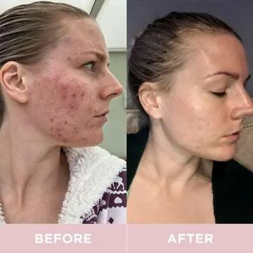 Revive Collagen Premium 8,500mg Hydrolyzed Marine Collagen Supplements Drink with Added Hyaluronic Acid & Aloe Vera for Healthy Skin, Hair, Nails & Joints | Lemon & Lime (14 Days Supply)