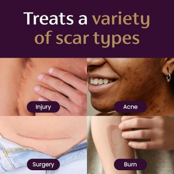 Mederma Scar Cream Plus SPF 30 - Best Scar Treatment