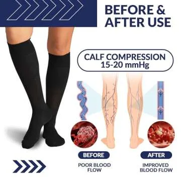SB SOX Compression Socks - Comfort & Support for All