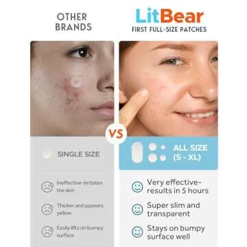 LitBear Large Acne Pimple Patches, 5 Sizes 80 Patches for Large Breakouts, Acne Patches for Face, Chin or Body, Acne Spot Patch with Tea Tree & Calendula Oil, Hydrocolloid Bandages for Acne Skin