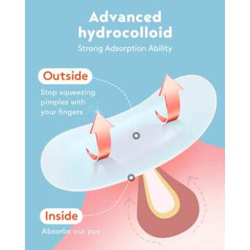 LitBear Large Acne Pimple Patches, 5 Sizes 80 Patches for Large Breakouts, Acne Patches for Face, Chin or Body, Acne Spot Patch with Tea Tree & Calendula Oil, Hydrocolloid Bandages for Acne Skin