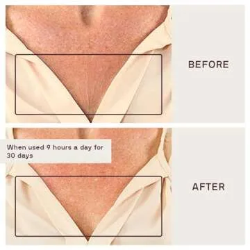 Dermaclara Chest Wrinkle Patch - Silicone Chest Patches for Wrinkles, Reusable Chest Wrinkle Pads, Overnight Scar Treatment for Pregnancy, Stretch Marks, Skin Repair, Up to 30 Uses - 2 Patches