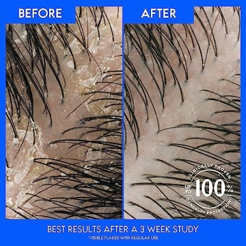 Head & Shoulders Anti Dandruff Shampoo 2 Pack