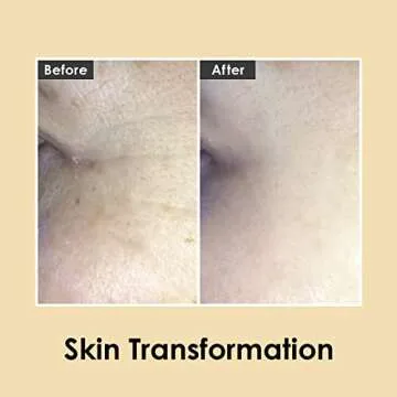 Medi-Peel Peptide9 Eye Cream for Dark Circles and Puffiness