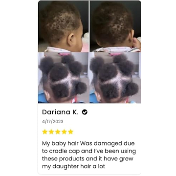Natural Kid's Hair Growth Stimulator with Oils
