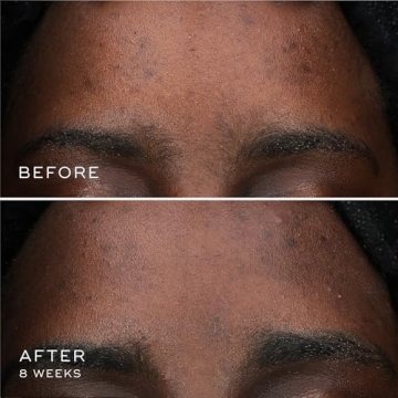 Medik8 Oxy-R Peptides Serum for Dark Spot Correction