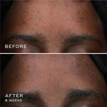 Medik8 Oxy-R Peptides Serum for Dark Spot Correction