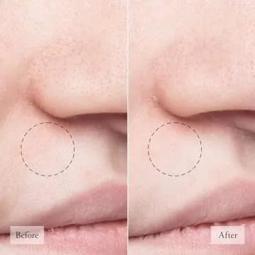 philosophy purity made simple pore extractor mask