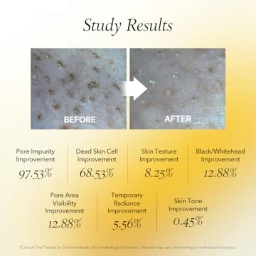 AprilSkin Calendula Facial Peel Off Mask - Glowing Skin Made Easy