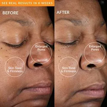 PMD Clean Mini Smart Facial Cleansing Device for All Skin Types