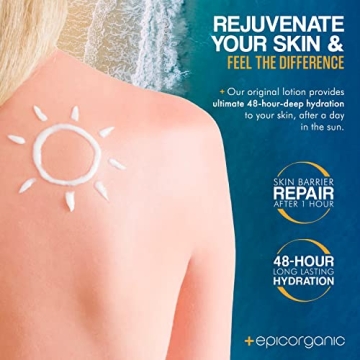 Epic Organicum After Sun Lotion for Sunburn Relief