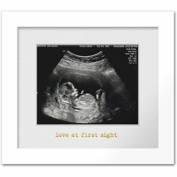 Sonogram Photo Frame for New Parents - Baby Shower Gift