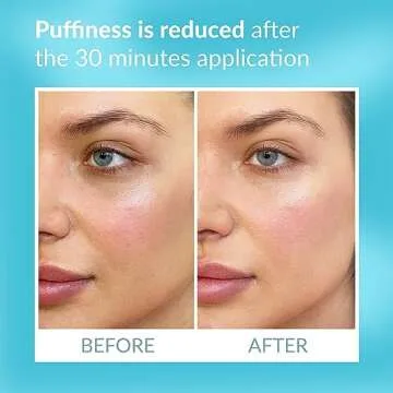 Talika Eye Therapy Patch - Instant Smoothing Under Eye Patches - Mask For Dark Circles Puffiness & Tired Eyes - 6 Refills Reusable Under Eye Patches for Adults Skincare Eye Treatment