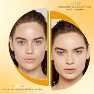 Nicgou Lemon Turmeric Kojic Soap, Turmeric Soap Bar for Face ＆ Body，Natural Turmeric Handmade Soap for All Skin Types (2pcs)