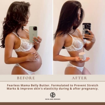 Natural Stretch Mark Prevention Belly Butter for Pregnant Moms
