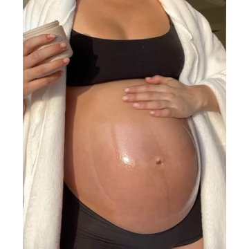 Natural Stretch Mark Prevention Belly Butter for Pregnant Moms