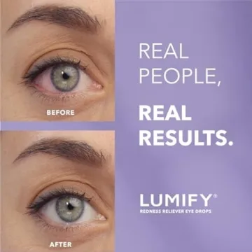 LUMIFY Redness Reliever Eye Drops, For Whiter & Brighter Looking Eyes, 0.17 Fl Oz (5 mL)