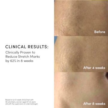 Evereden Golden Belly Serum | Clean Vegan Belly Oil