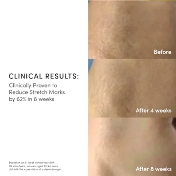 Evereden Golden Belly Serum | Clean Vegan Belly Oil