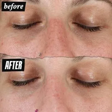 Kiehl's Clearly Corrective Dark Spot Serum, Brightening Facial Serum, Reduces Hyperpigmentation & Post-acne Marks, with Vitamin C & Salicylic Acid, All Skin Types, Paraben-free - 0.5 fl oz