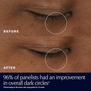 Estée Lauder Advanced Night Repair Eye Gel-Cream for Dark Circles