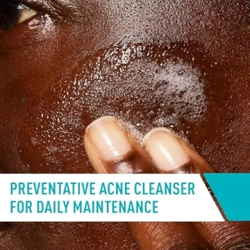 CeraVe Acne Control Cleanser with Salicylic Acid & Niacinamide