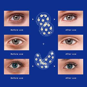 Gel Ice Pack Reusable Cooling Under Eye Pads and Patches, Hot Cold Treatment Pack for Redness,Pain Relief and Eye Relax