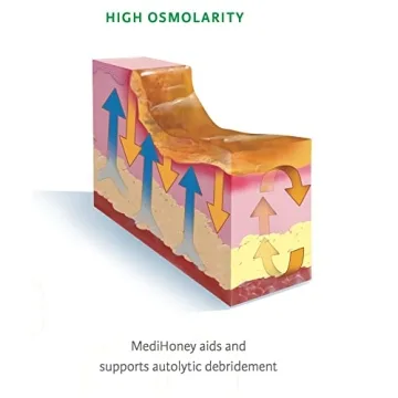 Medihoney Gel Wound and Burn Dressing - Fast Healing