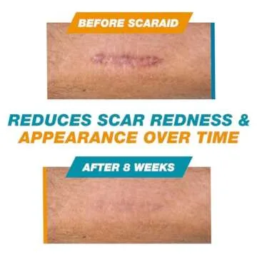 ScarAid SPF-15 Silicone Scar Gel Stick 4.25g – Mess-Free Scar Treatment with Sun Protection - Helps Improve the Look of Old & New Surgery, Injury & Acne Scars – Non-Toxic & Gentle on All Skin Types