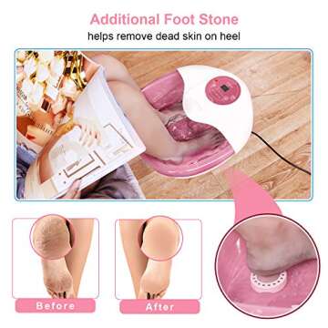 Foot Spa Misiki Foot Bath Massager with Heat Bubbles Vibration and Auto Shut-Off; 4 Massage Rollers and Pedicure Stone for Acupressure Shiatsu Massage to Relieve Feet Muscle Pain