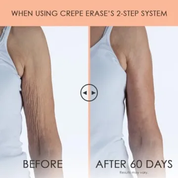Crépe Erase Advanced Body Repair Treatment for Firm Skin