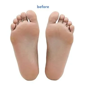 boscia Vegan Fruit Acid Foot Peel for Smooth Skin