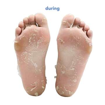 boscia Vegan Fruit Acid Foot Peel for Smooth Skin