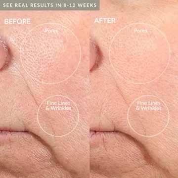 PMD Personal Microderm Pro Home Microdermabrasion Machine