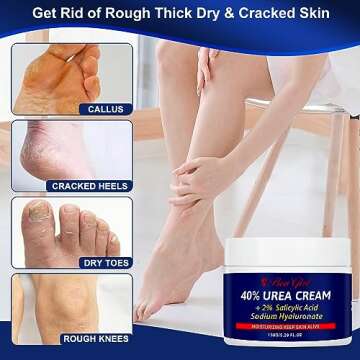 BeaGirl Urea Cream 40 Percent for Feet,Foot Cream & Hand Cream Maximum Strength with 2% Salicylic Acid,Hyaluronic Acid, for Dry Cracked Heels Feet Knees Elbows Hands-5.29 Fl.oz