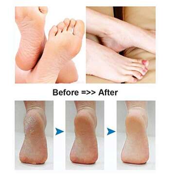 BOMPOW Electric Foot Scrubber - Smooth Callus Remover