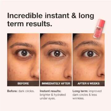 Bright & Tight Eye Cream + Bonus Acne Patch - Youthful Glow