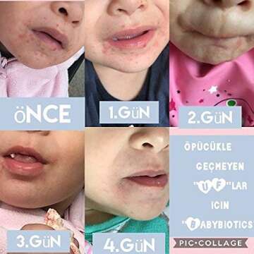 BabyBiotics - Natural Probiotic Body Care for Kids