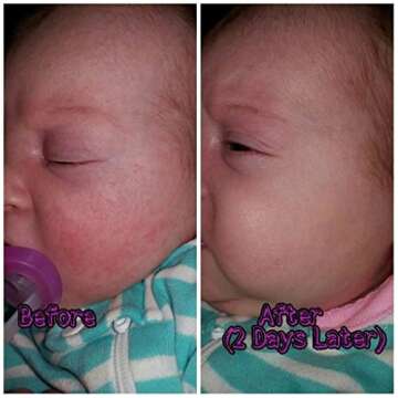 BabyBiotics - Natural Probiotic Body Care for Kids