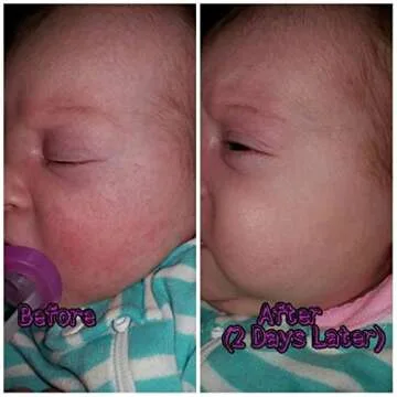 BabyBiotics - Natural Probiotic Body Care for Kids