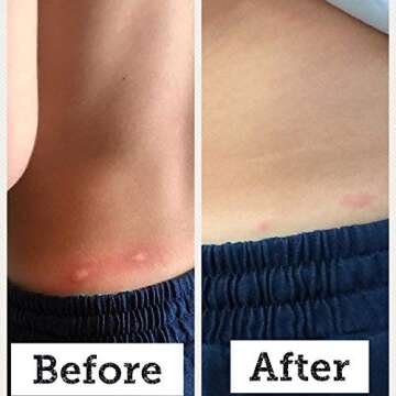 BabyBiotics - Natural Probiotic Body Care for Kids