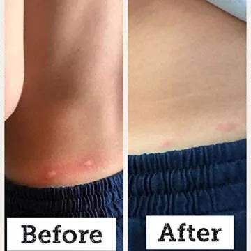 BabyBiotics - Natural Probiotic Body Care for Kids