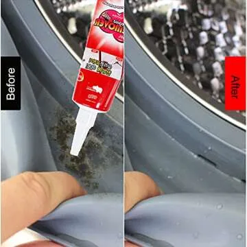 MXY Arbor Home Miracle Remove Gel for Black Spot Removal