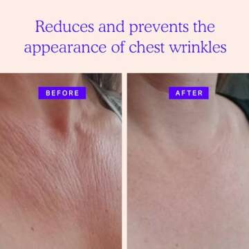 BLUMBODY Chest & Neck Wrinkle Pads - Advanced Silicone Anti Wrinkle Patches - Reusable Overnight Sil...