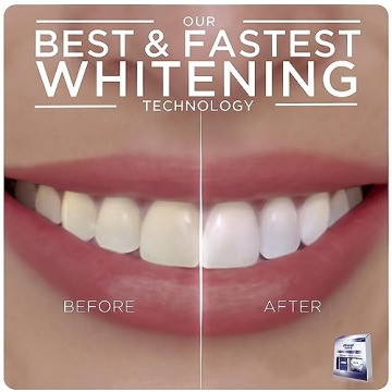 Crest 3D Whitestrips with Light, Whitestrips 3D White, Teeth Whitening Strip Kit, 20 Strips (10 Count Pack), Crest Teeth Whitening Strips, Teeth Whitening Kit