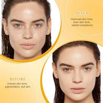 Nicgou Honey Glow Lemon Turmeric Kojic Soap Bar, Turmeric Soap Bar for Face ＆ Body，Natural Turmeric Handmade Soap for All Skin Types (2pcs)