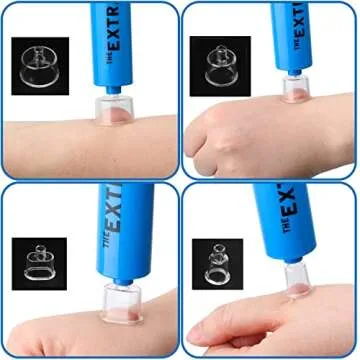 Snake Bite Kit, Bee Sting Kit, Emergency First Aid Supplies, Venom Extractor Suction Pump, Bite and Sting First Aid for Hiking, Backpacking and Camping. Includes Bonus CPR face Shield (Blue)