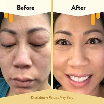 ECZEMA HONEY Oatmeal Facial Cleanser - Soothing Facial Cream - Bundle for Sensitive & Dry Skin - Cruelty Free